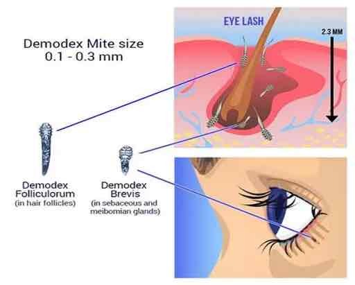 mites in eyelash diagram