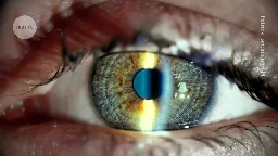 World-first stem-cell treatment restores vision in people