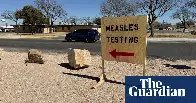 Kennedy Jr backtracks and says US measles outbreak is now a ‘top priority’ for health department